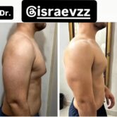 israer